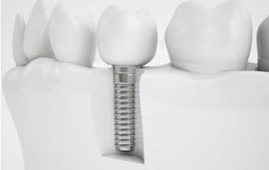 Hobe micro-tools for medical implants